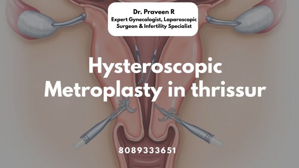 Hysteroscopic Metroplasty in Thrissur performed by expert gynecologist