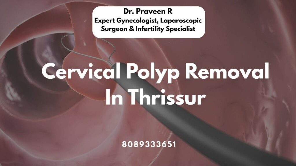 Woman consulting a doctor for cervical polyp removal in Thrissur