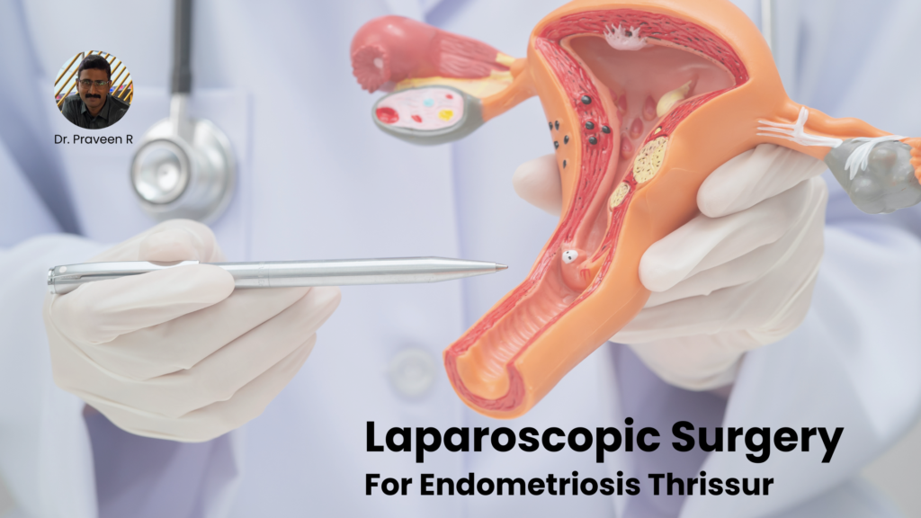 Laparoscopic Surgery For Endometriosis Thrissur